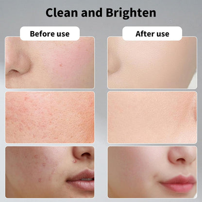 Resurfacing Glycolic Acid Exfoliating Pads